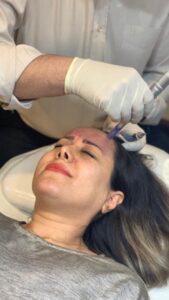 تزریق بوتاکس , لیفت صورت , تزریق ژل , تزریق چربی