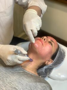 تزریق بوتاکس , لیفت صورت , تزریق ژل , کربوکسی تراپی