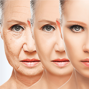 تزریق بوتاکس , لیفت صورت , تزریق ژل , کربوکسی تراپی , لیفت با نخ